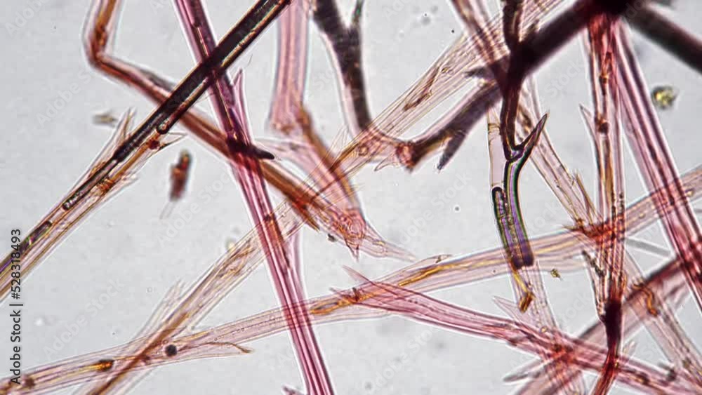 Dandelion fuzz whole mount magnified under microscope in 400 times on ...