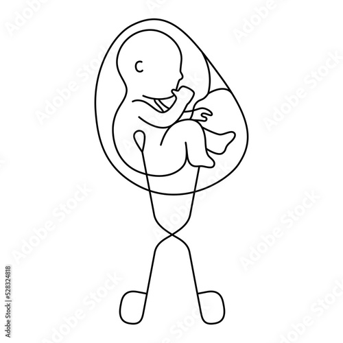 Fetus baby is removed from the womb with gynecological forceps line style vector illustration
