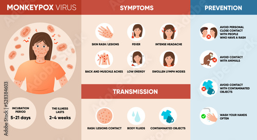 Monkeypox virus symptoms, transmission and prevention infographic. Poster for social media, articles and flyers. Vector illustration.