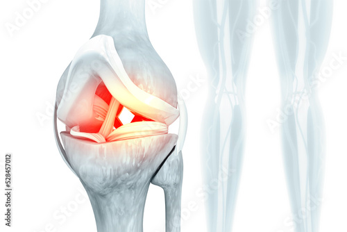 Foto Accurate medically 3d illustration showing knee joint with ligaments