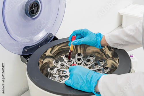 Cropped hands of nurse insert test tubes with people's blood tests into centrifuge. Medical laboratory.