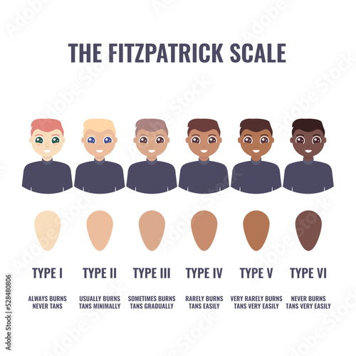 Fitzpatrick skin type classification scale shown in men. Human skin tone pigmentation diversity infographics. Six phototypes from fair to dark complexion variations. Vector cartoon illustration.