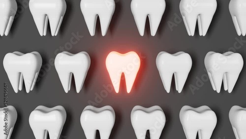 Toothache 3D loop seamless animation on grey background. White healthy teeth pattern molar tooth with pain National Dentist's Day Wisdom teeth extraction Oral care recovery. Dental Insurance Dentistry