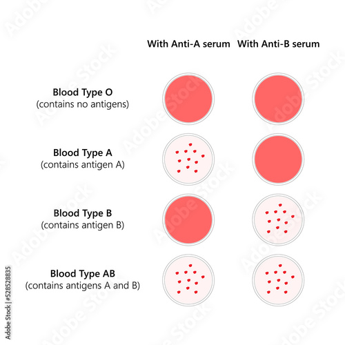Blood typing of ABO blood types.