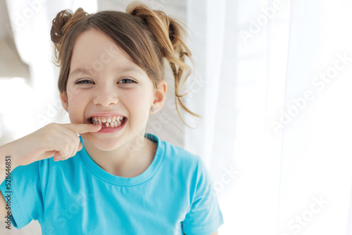 Foto The child has lost a tooth