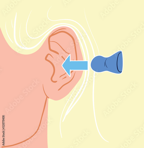 Earplugs and ear and girl at night in bed. Ear plug sign. Noise symbol. Sleeping quality concept. Turquoise square button. Vector