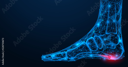 Heel spur, injury to the plantar ligament of the leg. Polygonal design of interconnected lines and points. Blue background. photo
