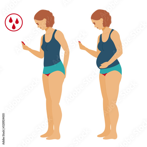 First menstruation. Uterine bleeding. Miscarriage and abortion. Young pregnant woman has misbirth. Rh-conflict during pregnancy. Spotting from the vagina. stock vector illustration.