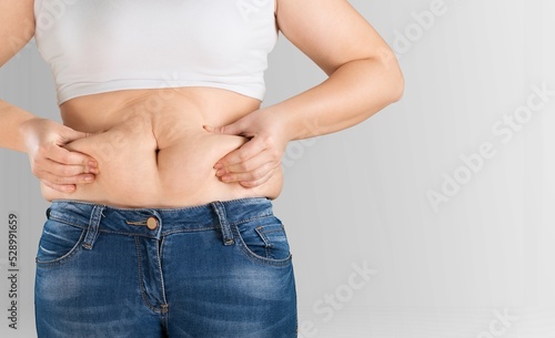 Obese woman against light background. Weight loss surgery concept