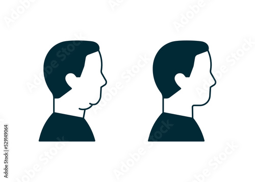 Double chin of man icon, change in facial aesthetics. Fat loss in overweight on face. Profile male before and after liposuction, lifting, plastic procedure. Vector illustration