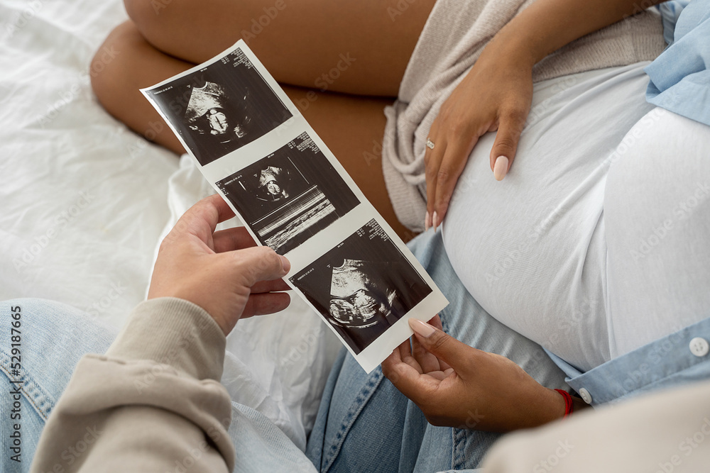 Multiethnic pregnant couple watching ultrasound image picture at home. Closeup feeling happy, stroking tummy and excited on seeing baby ultrasound