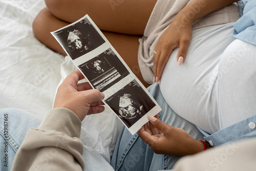 Obraz na płótnie Multiethnic pregnant couple watching ultrasound image picture at home. Closeup feeling happy, stroking tummy and excited on seeing baby ultrasound w salonie