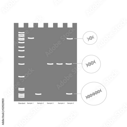 The different size of the DNA molecule in unknown sample that were separated by gel electrophoresis technique and the result showed on different position on the gel.