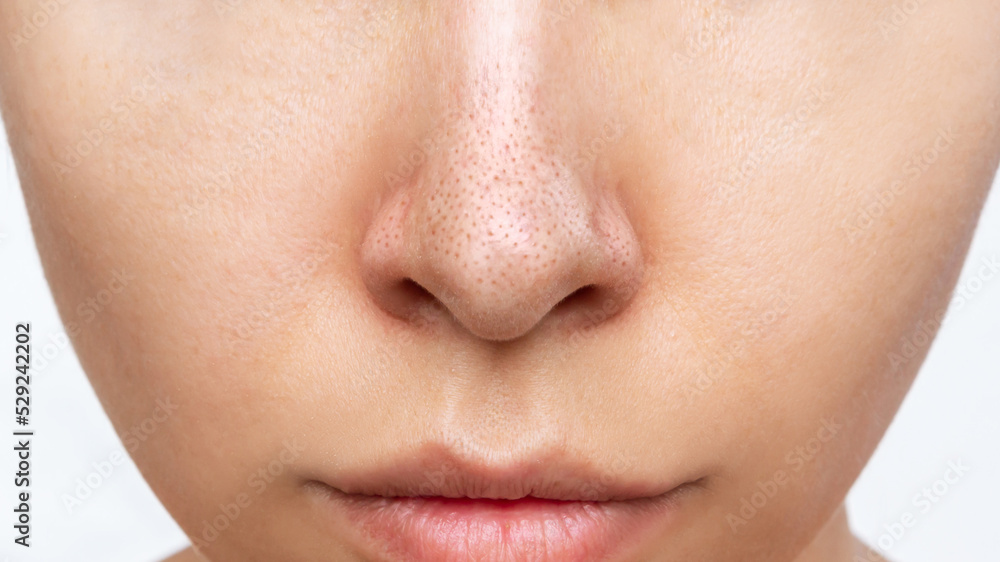 Close-up of woman's nose with black heads or black dots isolated on a white background. Acne problem, comedones. Enlarged pores on the face. Blackheads on greasy skin Close-up of woman's nose with black heads or black dots isolated on a white background. Acne problem, comedones. Enlarged pores on the face. Blackheads on greasy skin