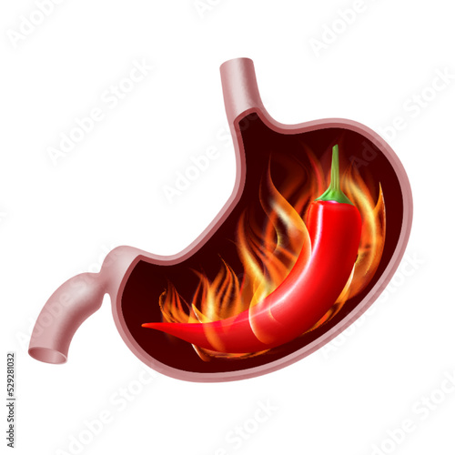 Opened Stomach with red pepper in fire. Spicy food gastritis.
