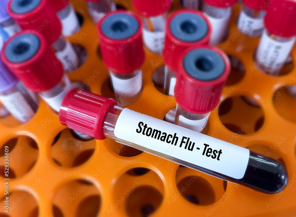 Blood sample for Stomach Flu(viral gastroenteritis) test to diagnosis