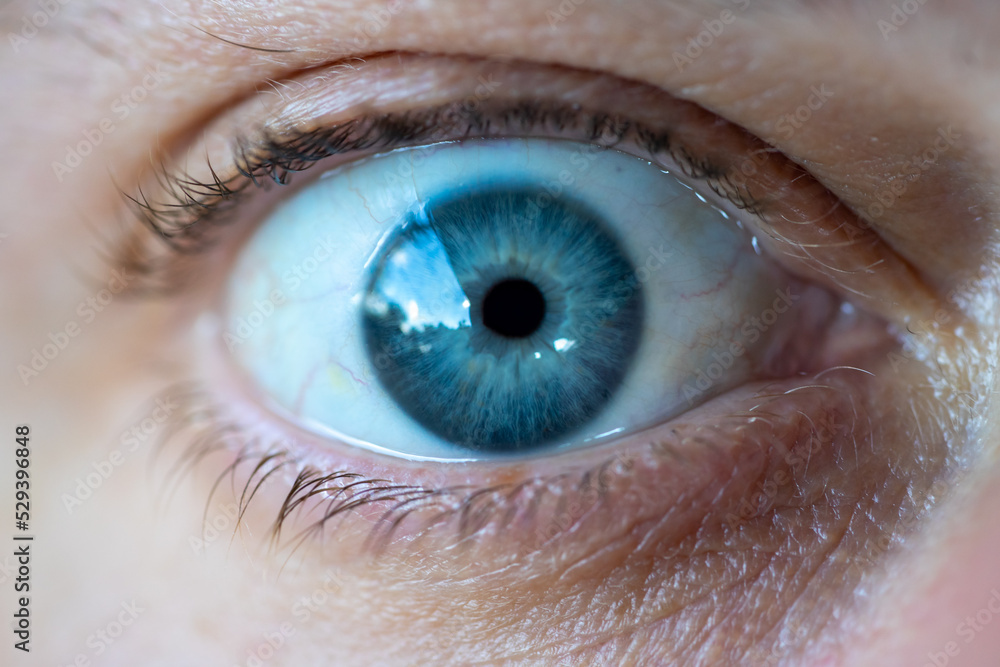 Fototapeta premium Blaues Auge im Detail beim Augenarzt