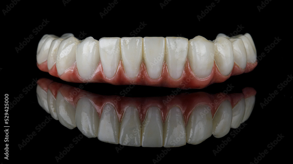 nature-like dental prosthesis of the lower jaw with gums on a black background with creative reflection nature-like dental prosthesis of the lower jaw with gums on a black background with creative reflection