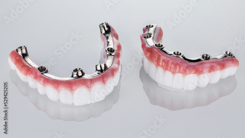perfect composition of the prosthesis of the upper and lower jaws from zircon and titanium bars on a white background