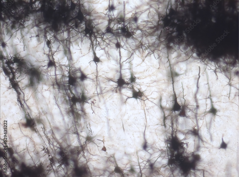 Obraz premium Mouse brain section stained with the Golgi stain, a 19th century technique that was widely used until recently - and occasionally still is. Neurons and some vessel fragments in the cerebral cortex.