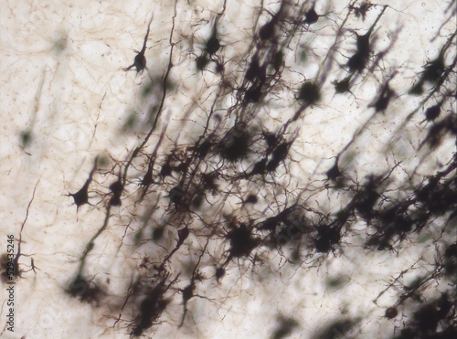 Mouse brain section stained with the Golgi stain, a 19th century technique that was  widely used until recently -  and occasionally still is.  Neurons and some vessel fragments in the cerebral cortex.