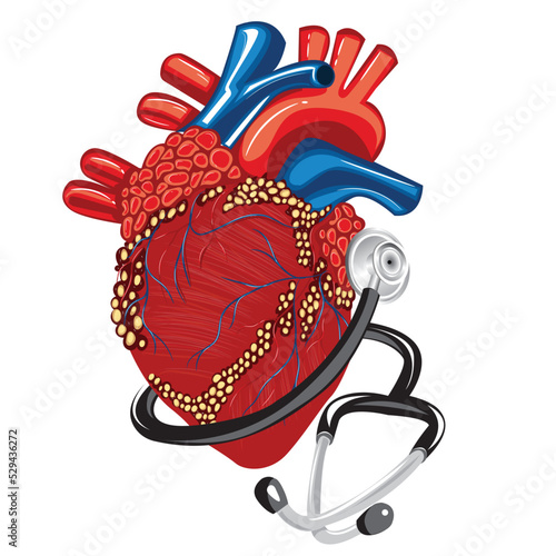 Real heart with stethoscope. Vector illustration.
