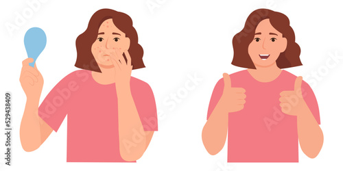 Young girl has problem skin, acne, pimples,blackheads and spots. Before, after. Healthy skin.Skincare and dermatology. Teenage skin. Flat vector illustration
