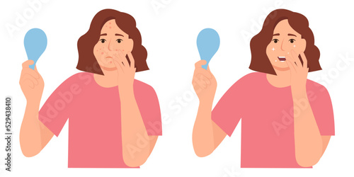 Young girl has problem skin, acne, pimples,blackheads and spots. Before, after. Healthy skin.Skincare and dermatology. Teenage skin. Flat vector illustration