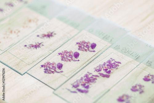 Photos Stained tissue biopsy on glass slides in pathology laboratory
