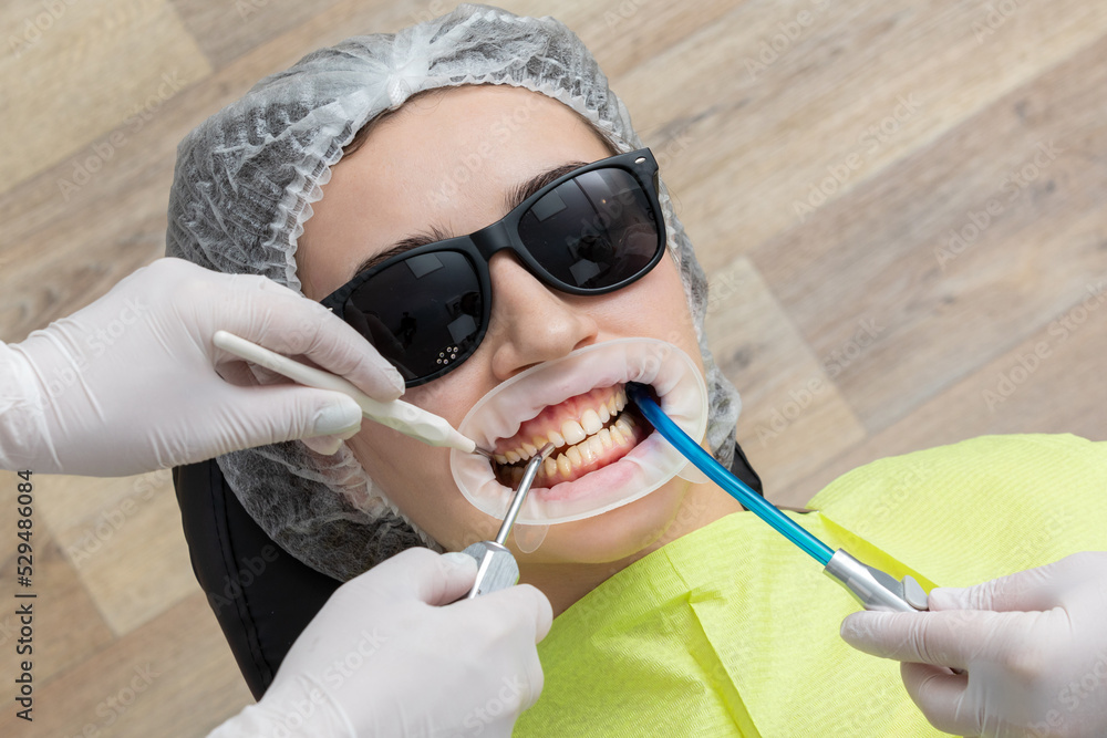 Patient with cheek retractor lying in dentist office Stock Photo ...