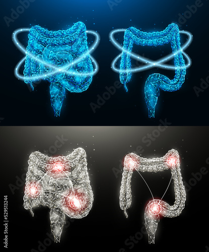 Polygonal vector illustration of an inflamed human intestine and recovery of intestinal function. Internal organs low poly design. Medical banner, template or background.
