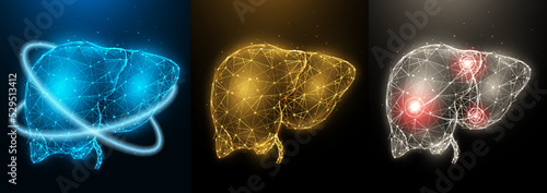 Polygonal vector illustration of inflamed diseased human liver, healthy liver and recovery of liver functions. Internal organ low poly design. Medical banner, template or background.