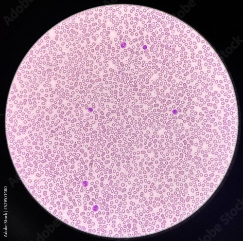 Normochromic and normocytic rbc blood smear. photo