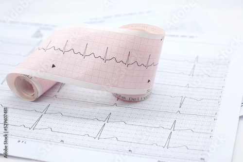 ekg paper showing the results of the electrocardiogram There is a medicine bottle placed on the side.