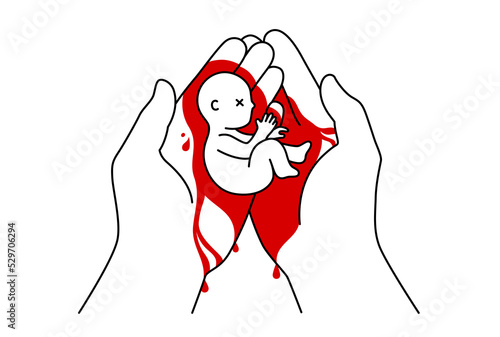 Two hands covered in blood holding a dead baby after miscarriage outline style vector illustration