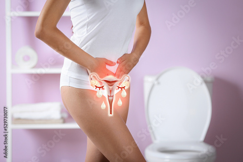 Woman holding hands on her belly and illustration of female reproductive system. Vaginal yeast infection photo