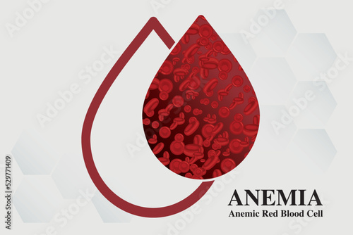 Anemia Iron red blood cell medical vector illustration medical.

