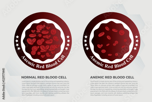 Anemia Iron red blood cell medical vector illustration medical.

