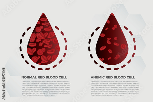 Anemia Iron red blood cell medical vector illustration medical.
