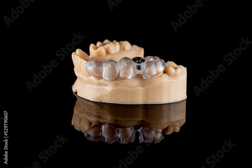 Guide for dental implant