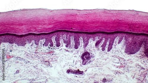 Human skin. Light micrograph of epithelial tissue from the skin. Human finger section showing epidermis (stratified squamous epithelium), dermis and connective tissues. Hematoxylin and Eosin Staining. photo