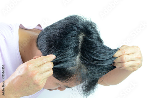 White hair problems in men, asian man with white hair, white hair or hair loss problem.