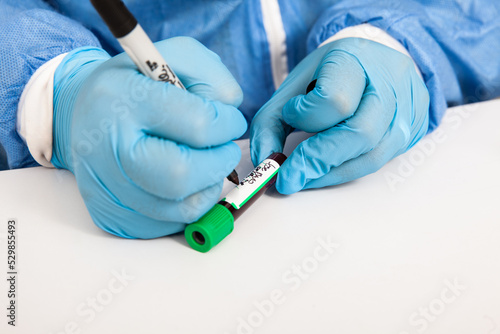 Closeup of a nurse labelling a test tube with blood sample in a clinical laboratory