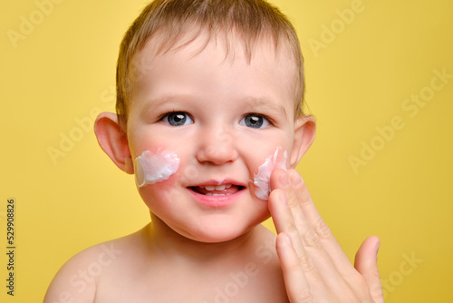 Mother smears allergy cream on face of toddler baby, studio yellow background. Close-up portrait of a cute baby with cream on her cheeks. Kid aged one year and two months