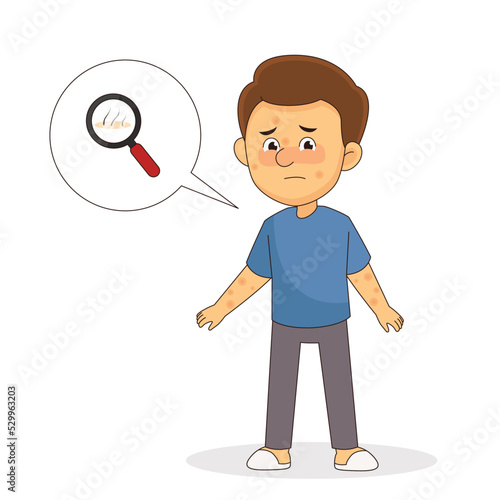 Man Person With Allergy Rashes And Dermatitis