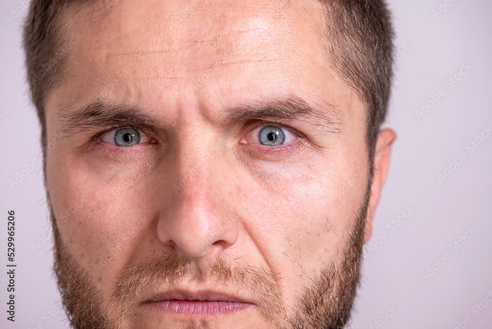 Obraz premium Angry, nervous, doubtful, unhappy, frustrated man frowning his eyebrows. Annoyed closeup face portrait.