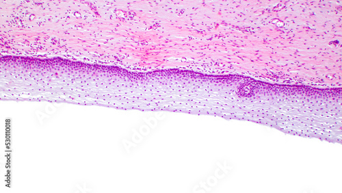 Vaginal epithelium (Non-keratinized stratified squamous epithelium of the vagina), light micrograph. photo