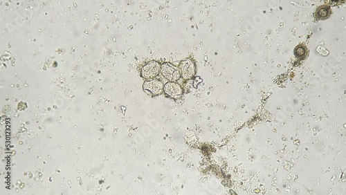 Whole mount of Taenia solium eggs under microscope on white background with 200 times magnification. Macro view of pork tapeworm on scientific slide for studying. Parasites in environment. Pests theme photo
