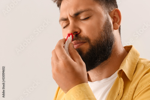 Young bearded man with nosebleed and tissue on light background, closeup photo
