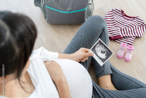 pregnant woman is looking at an ultrasound photo of fetus. Mother gently touches the baby on stomach.Women are pregnant for 12 weeks. first love in belly and Last term pregnancy photo